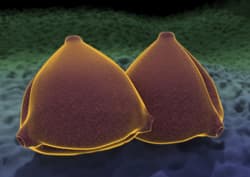 Pollen-Analyse